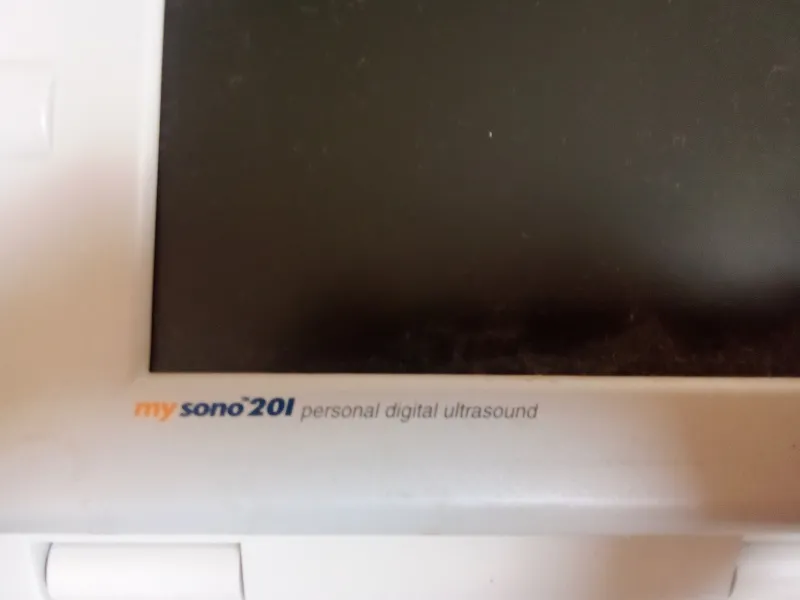 Ultrazvuk Samsung my sono 201